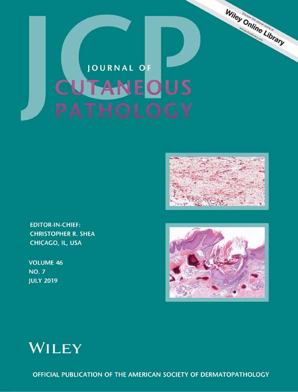 Journal of Cutaneous Pathology Cover July 2019