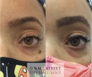 mole1-e1705325544788